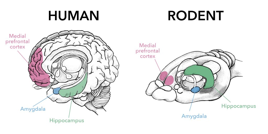 amygdala hippocampus prefrontal cortex