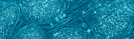 Uncertain Precedents: An Analysis of Stem Cell Regulation